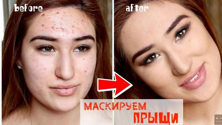 Как замаскировать прыщи на лице