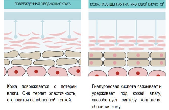 Как работает гиалуроновая кислота
