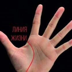 Линия жизни